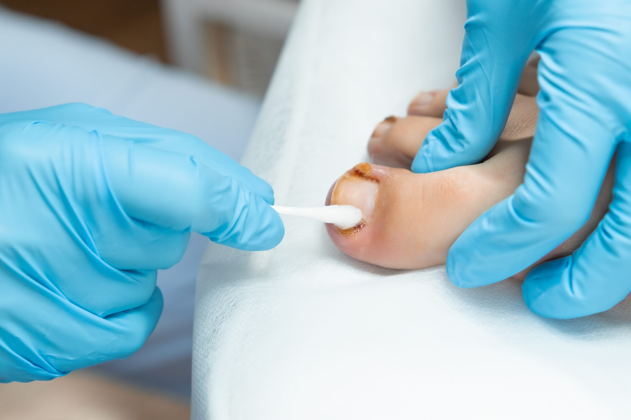 Close up a womans feet following podiatric care.
