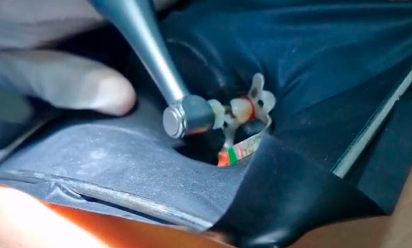 Endodoncia