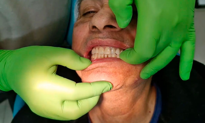 Maxilofacial