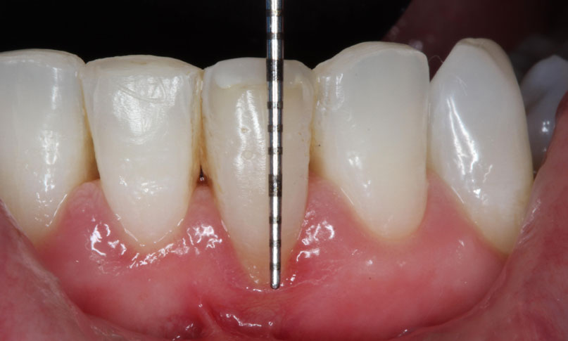 Periodoncia