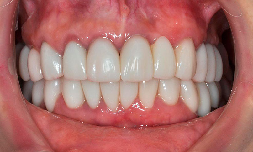 Periodoncia