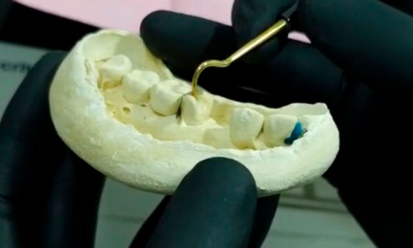 Rehabilitación Oral