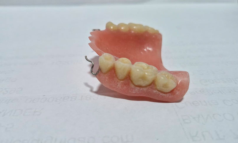 Rehabilitación Oral